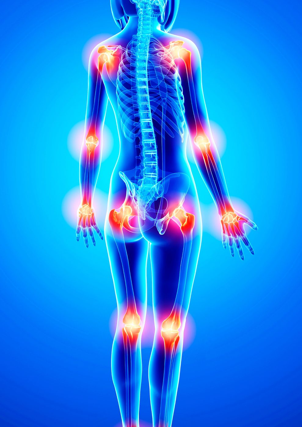 Joint pain and rheumatology