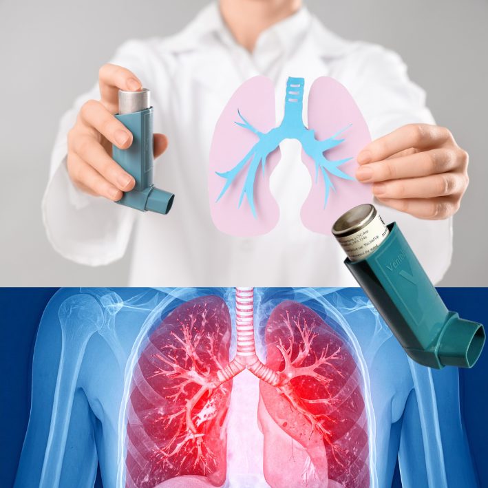 Respiratory health and asthma